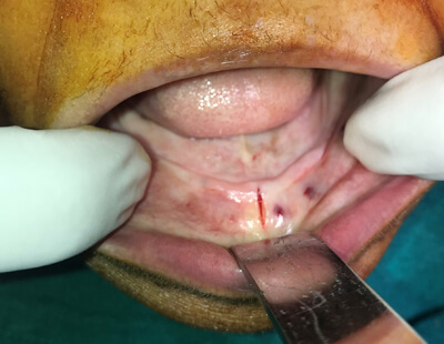 implant dentistry