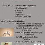 TM Joint Arthroscopy